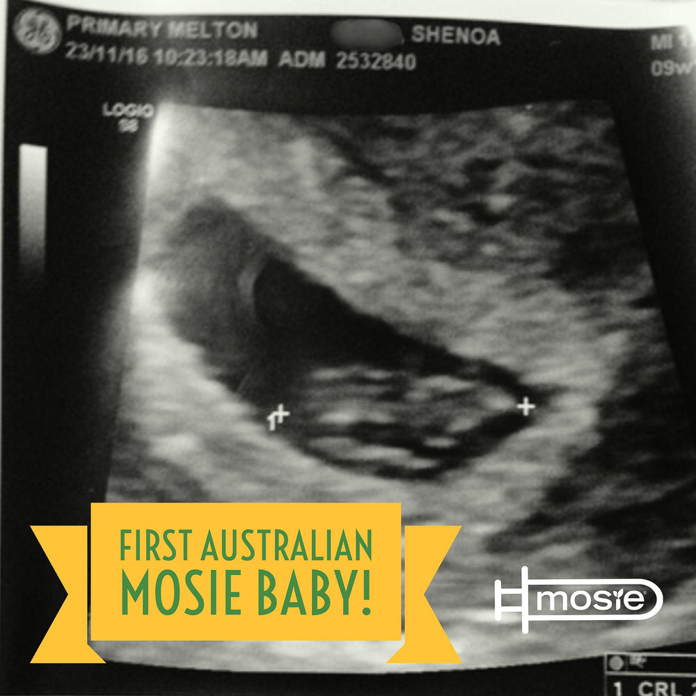 Sonogram of an Australian mosie baby